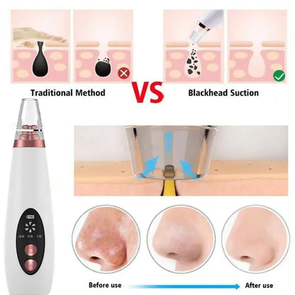 USB rechargeable blackhead remover device charging

