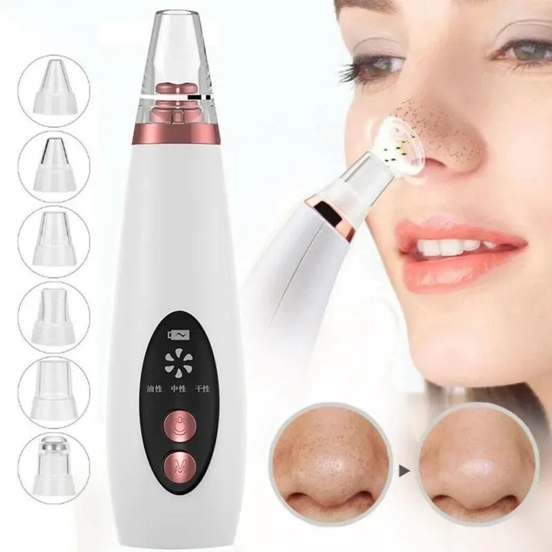 USB rechargeable blackhead remover vacuum for deep pore cleansing
